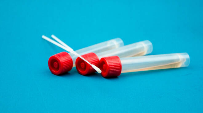 tampone-per-il-coronavirus-1