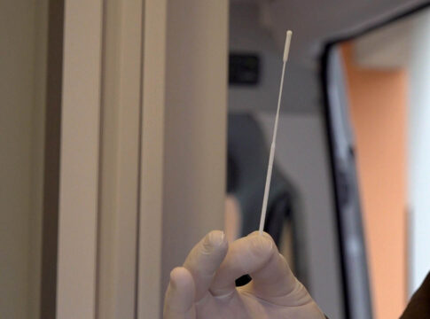test-antigenici-covid-19